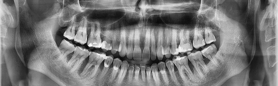 Kompleksowa diagnostyka periodontologiczna: od wywiadu lekarskiego po badanie kliniczne 