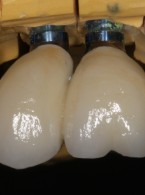 Czynniki wpływające na wybór sposobu odbudowy koron zębów 
